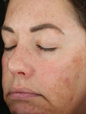 Dg before