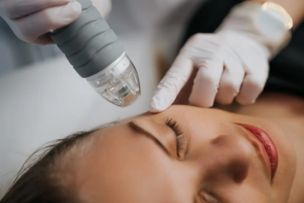 Microneedle RF lifting in a beauty salon. Big plan.